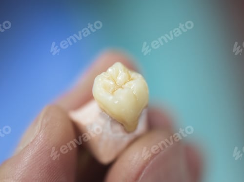 Preview: Dental Prosthesis