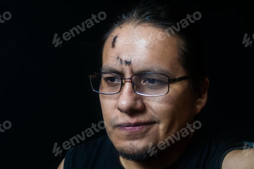 Preview: Portrait of a Latino man with 6 stitches on his forehead having a disappointed expression.
