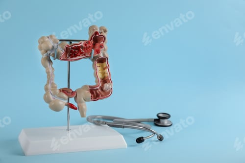 Preview: Human colon model and stethoscope on light blue background. Space for text