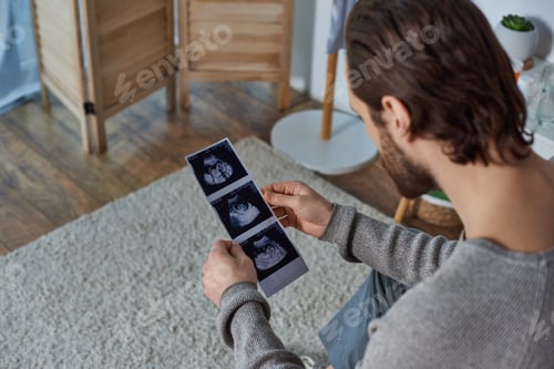 Preview: bearded man holding ultrasound photo, sitting on bed, pregnancy, responsibility, future father