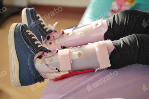 Preview: little girl with legs orthosis shoes sitting on bed