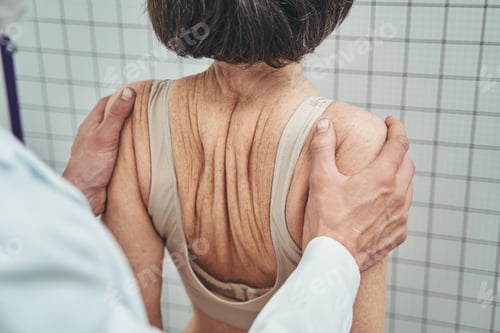 Preview: Physician testing a woman for scoliosis in the standing position