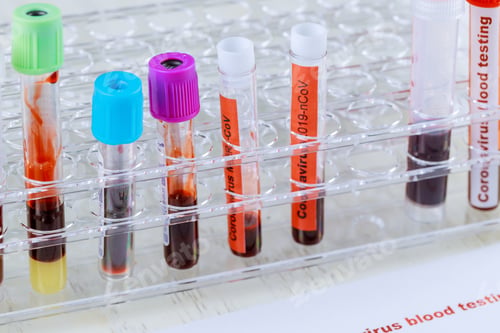 Preview: Coronavirus blood test 2019-nCoV,SARS-CoV, MERS-CoV chinese infection blood test in Laboratory