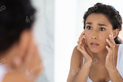 Preview: Atopic Skin Concept. Worried Young Woman Looking At Mirror And Touching Face