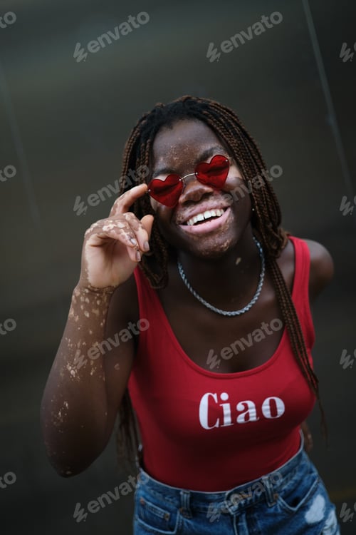 Preview: Young African American woman with vitiligo wearing heart-shaped sunglasses and smiling.