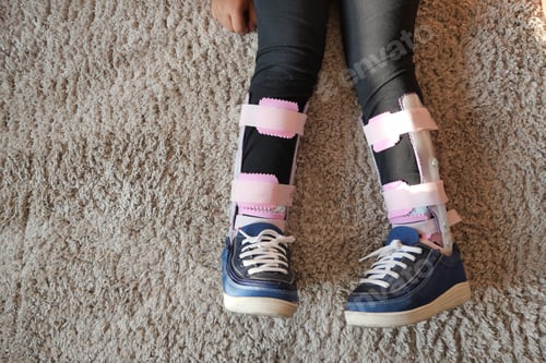 Preview: Child cerebral palsy disability, legs orthosis.
