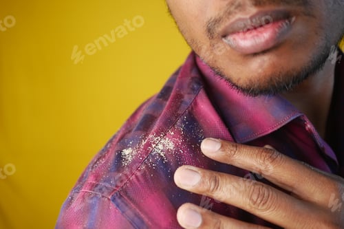 Preview: dandruff on person shoulder on his shirt closeup