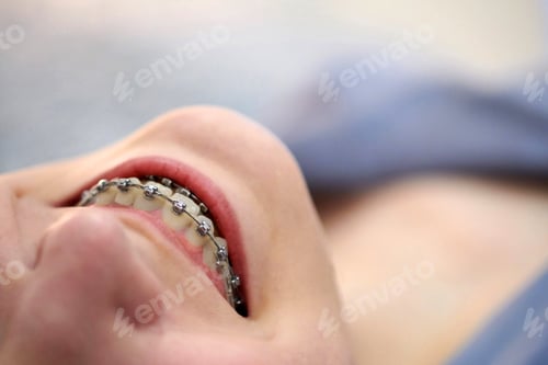 Preview: Smiling girl with braces close up.