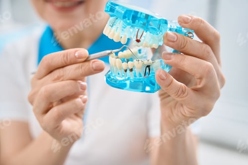 Preview: Female dental technician showing tooth with caries or decay on 3d model