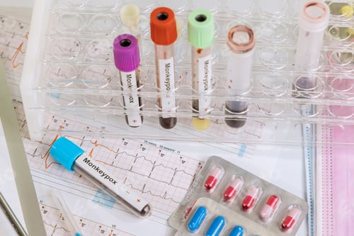 Preview: Blood sample many others blood test tubes exam analysis hospital positive with Monkeypox smallpox