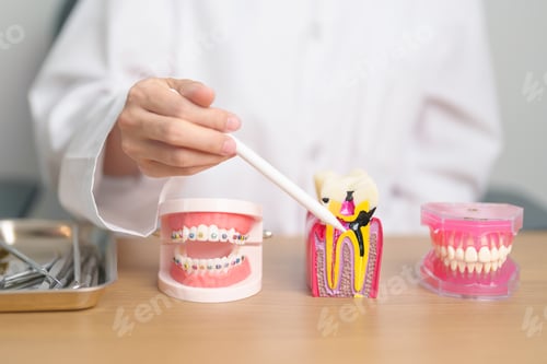 Preview: Tooth Anatomy and Orthodontic model on dentist table.