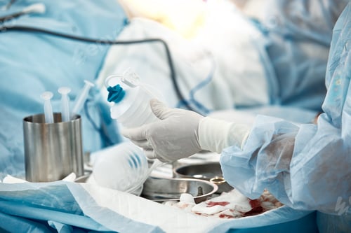 Preview: Mamoplasty, breast reconstruction, the surgeon's hands place an expander to correct the mammary