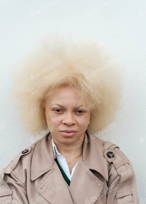 Preview: An albino woman is looking at camera leaning on a white wall.