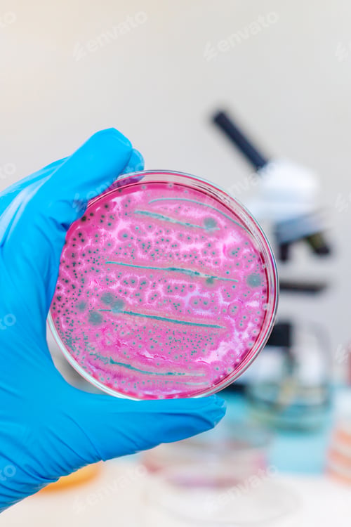 Preview: Examine bacteria in petri dishes in the laboratory. Selective focus.