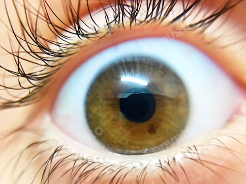 Preview: Human eye