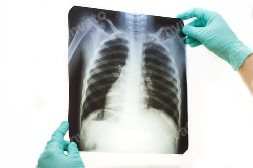 Preview: Man hand holding a lungs radiography isolated on a white background.