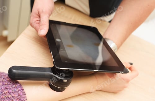 Preview: dermatologist examines moles on a female patient's arm with a dermatoscope and a computer tablet