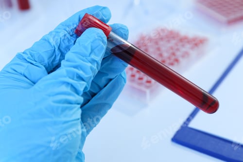 Preview: Test tubes with donor blood in doctor's hand on light background, close up