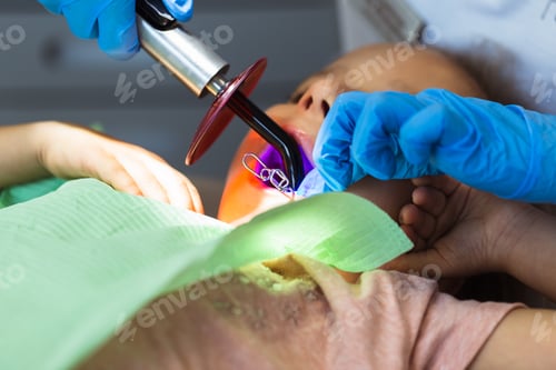 Vista previa: Child to the dentist. Child in the dental chair dental treatment