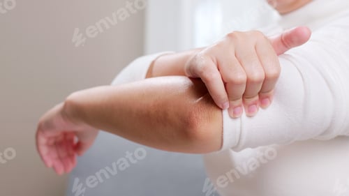 Preview: Young woman having pain in her elbow and using hand for self-massage to relieve aches and pains.