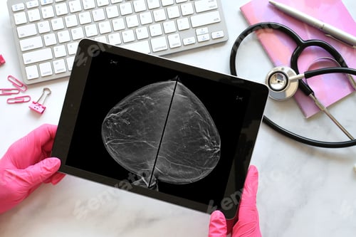 Preview: Doctor or radiologist examining mammogram scans to detect signs of breast cancer - October awareness