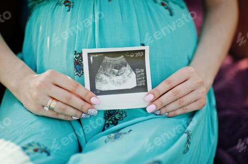 Preview: Happy pregnant couple. Close up photoshoot ultrasound