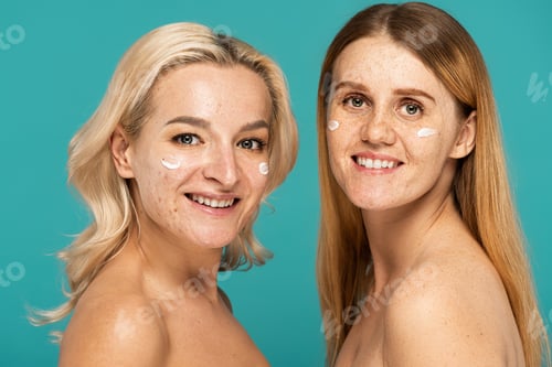 Preview: cheerful women with different skin conditions and cream on faces looking at camera isolated on