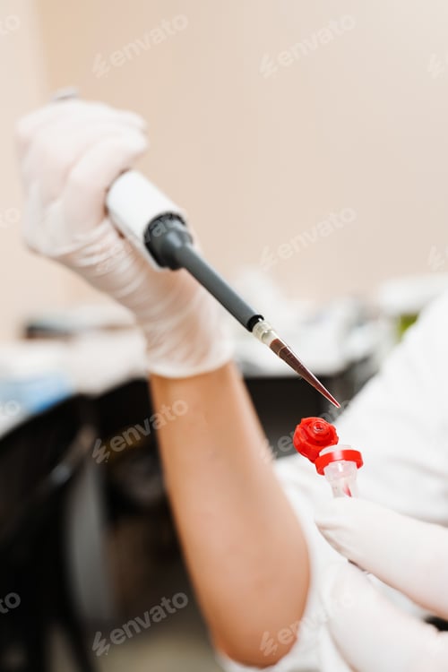 Preview: Blood analysis with microdoser in laboratory by assistant, using hematology lab tools
