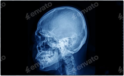 Preview: X-Ray film scan of human.