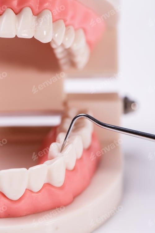 Preview: White teeth