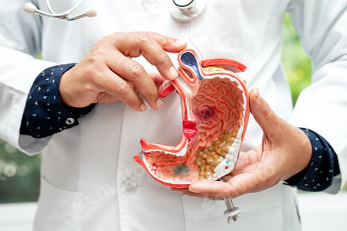 Preview: Stomach disease, doctor holding anatomy model for study diagnosis and treatment in hospital.