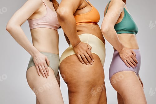 Preview: Different Female Bodies