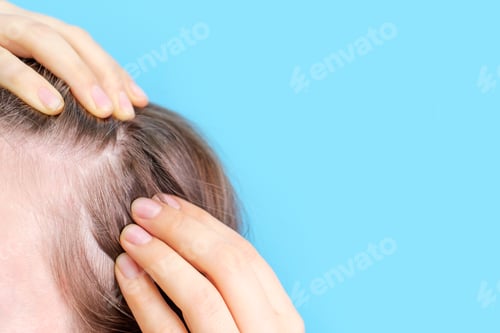 Preview: Girl touching her hair close-up on blue background, hair loss concept.
