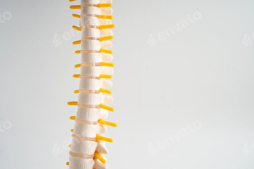 Preview: Lumbar spine displaced herniated disc fragment, spinal nerve and bone. Model for treatment medical