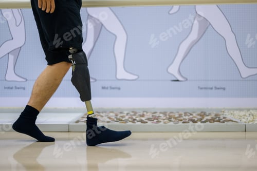 Preview: Athlete man with prosthetic leg walking at health care center