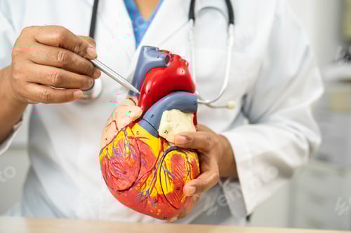 Preview: Cardiovascular disease CVD, Asian doctor holding human anatomy model