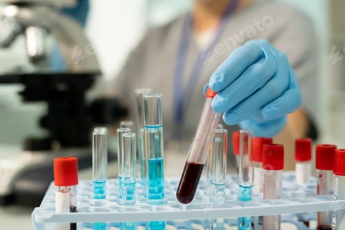 Preview: Examining blood sample in laboratory