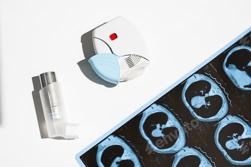 Preview: Some Asthma Inhalers and CT Scan of the Lungs on White Table.