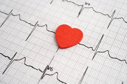 Preview: Red heart on electrocardiogram ECG with red heart, heart wave, heart attack, cardiogram report.