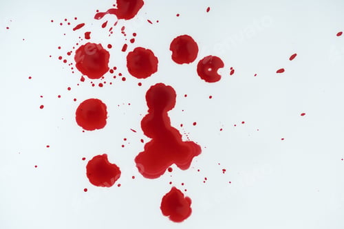 Preview: top view of white surface covered with blood blots