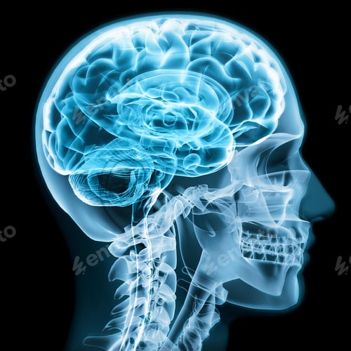 Preview: Xray closeup