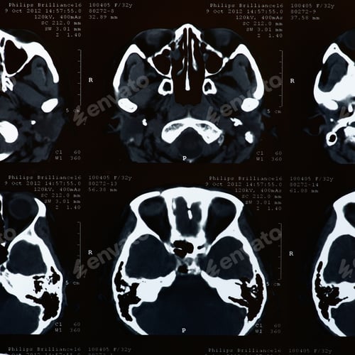 Preview: x-rays