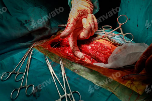 Preview: Surgeon doctor close up hands of open heart of surgeons