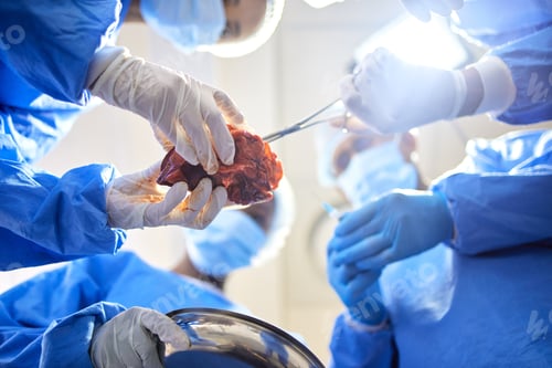 Preview: Organ, group hands and doctor surgery, medical support or teamwork on saving life, healing accident
