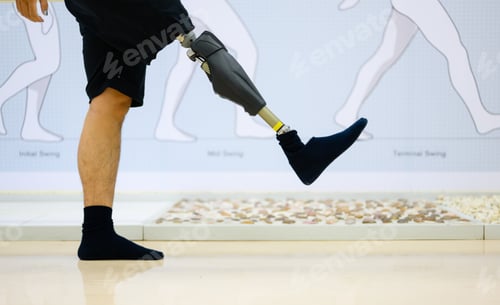 Preview: Disabled athlete patient with physical disability doing exercise