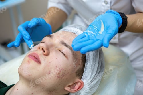 Preview: A young Caucasian teenage boy has a cosmetologist cleaning his face. A dermatologist treats acne on