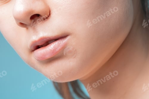 Preview: Girl with acne stick round acne patch on her cheek