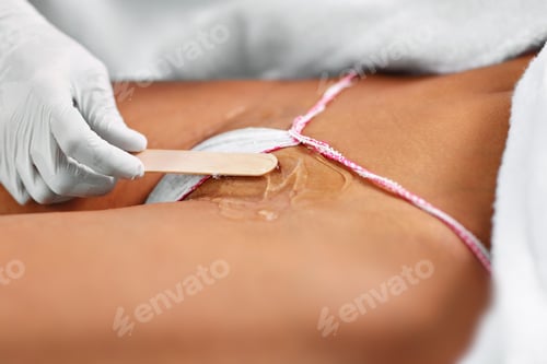 Preview: Beautician Giving Epilation Laser Treatment To Woman On Bikini