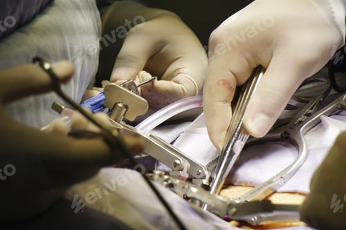 Preview: Closeup shot of doctors performing a spinal surgery under the lights - surgical concept