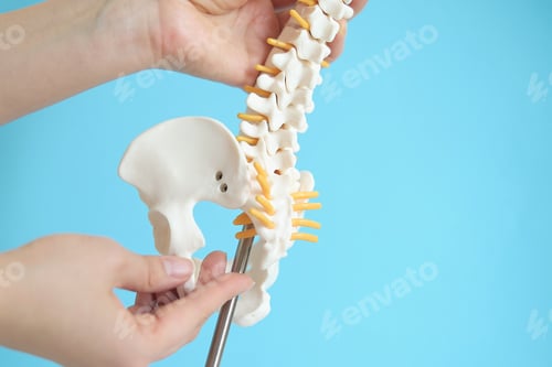 Preview: Intervertebral hernia of the cervical spine, rupture of the fibrous ring.